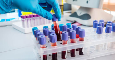 Tây Ban Nha: Phần lớn bộ kit xét nghiệm nhanh nCoV của Trung Quốc cho kết quả sai