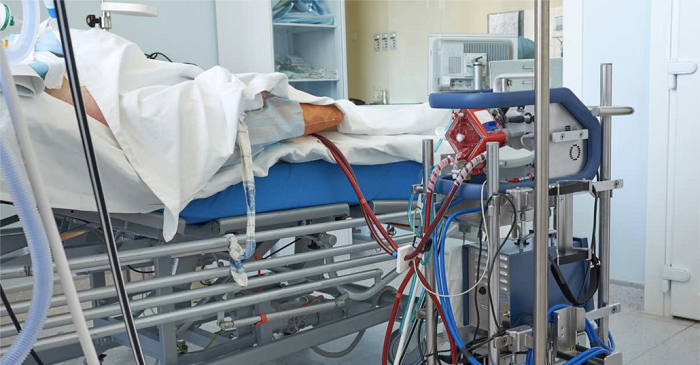 Bệnh nhân số 91 vẫn phải dùng máy hỗ trợ tim phổi ECMO và lọc máu liên tục