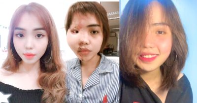 Cô gái bị chồng sắp cưới tạt axit đăng video về thay đổi diện mạo sau 16 cuộc phẫu thuật