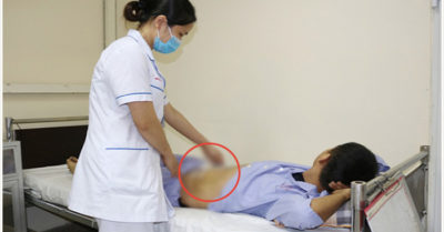 Tập gym sai cách, nam thanh niên 21 tuổi đứt cơ bụng