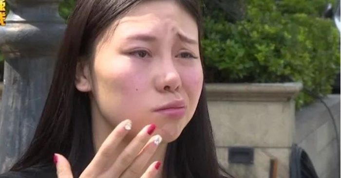 Cô gái bị méo miệng, không nhắm được mắt vì tiêm filler giúp trẻ hóa da