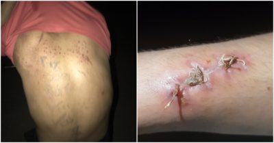 Tạm giữ chủ quán bánh xèo Miền Trung hành hạ nhân viên ở Bắc Ninh