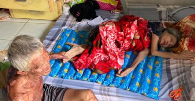 Cụ ông bán bánh bao bị bỏng toàn thân mong muốn ngưng nhận tiền, để dành cho hoàn cảnh khó khăn khác