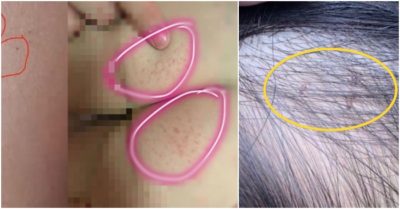 Phụ huynh phát hiện nhiều lỗ kim trên người con, 3 giáo viên mầm non bị tạm giữ