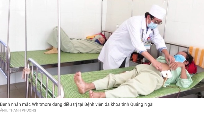 Bệnh nhân mắc bệnh ăn thịt người đang điều trị tại bệnh viện Quảng Ngãi.