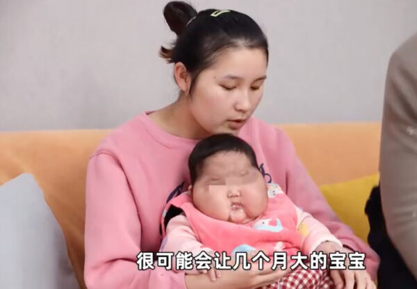 Ảnh chụp màn hình video cho thấy người mẹ và em bé nghi bị dị tật tăng trưởng vì loại kem bôi da do Trung Quốc sản xuất.