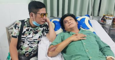 Nghệ sĩ Trọng Phúc bị người say đâm xe máy, phải nhập viện