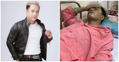 Nam ca sĩ 38 tuổi người tím tái, ăn uống khó khăn vì ung thư não