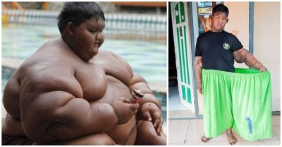 Cậu bé từng được mệnh danh ‘béo nhất thế giới’ giờ ra sao?