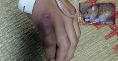 Người đàn ông mắc dịch hạch sau khi bị chuột cắn