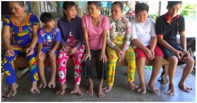 Kỳ lạ: Gia đình 20 người thì 13 người có bàn chân chỉ 2 hoặc 3 ngón