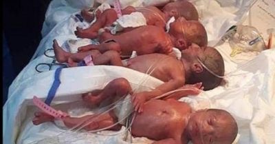 Video bác sĩ ‘phát hoảng’ vì thai phụ sinh liền một lúc 9 em bé