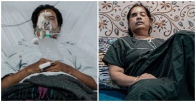 Ác mộng tiếp theo sau Covid-19: Dịch nấm đen khiến nhiều người phải khoét mắt, xẻo mũi