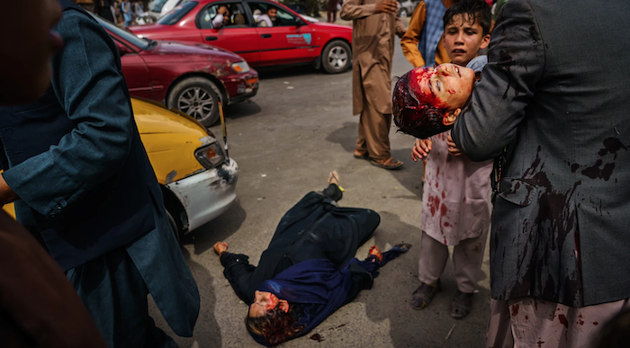 Một người đàn ông bế một đứa trẻ đẫm máu, trong khi một phụ nữ nằm bị thương trên đường phố sau khi các chiến binh Taliban sử dụng súng, roi, gậy và vật sắc nhọn để kiểm soát đám đông đổ về sân bay Kabul (ảnh chụp màn hình MARCUS YAM/LOS ANGELES TIMES/Shutterstock).