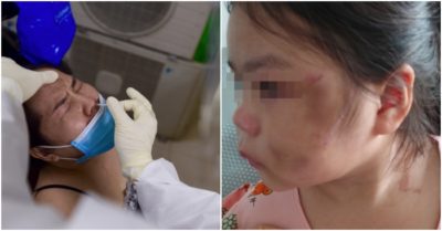 Cập nhật tối 1/10: Thêm 6.957 ca Covid-19; Biển Đông sắp đón bão; Bé gái 6 tuổi bị cha ruột đánh tím mắt khi kèm học online