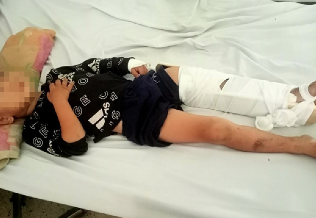 Bé trai nằm viện sau khi bị xe tông (ảnh chụp màn hình PLO).