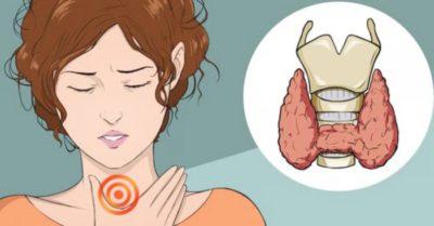 6 thói quen xấu gây nên bệnh tuyến giáp, không nên chủ quan